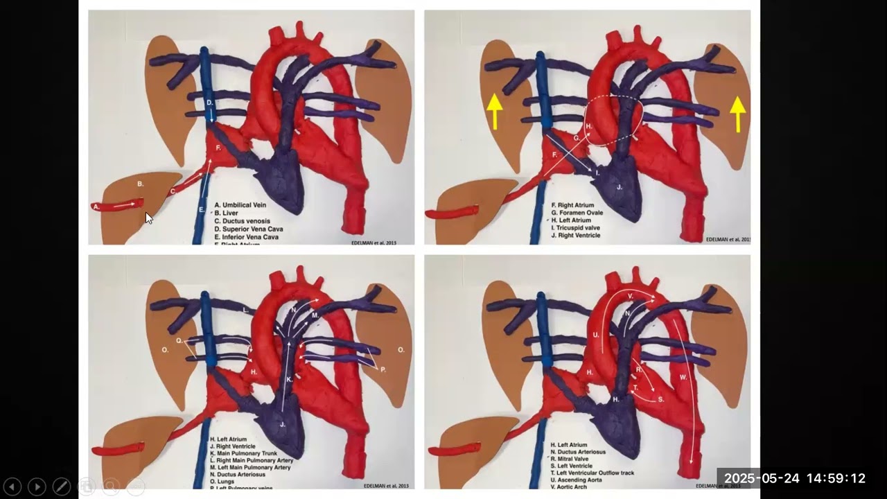 Echopedia Lectures   Fetal Echo orientation Part 2 By Dr Sameh Abdellatif