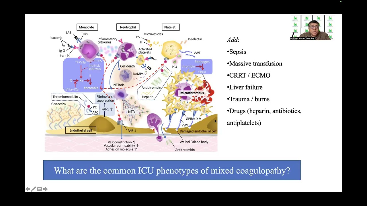 Mixed coagulopathy in ICU