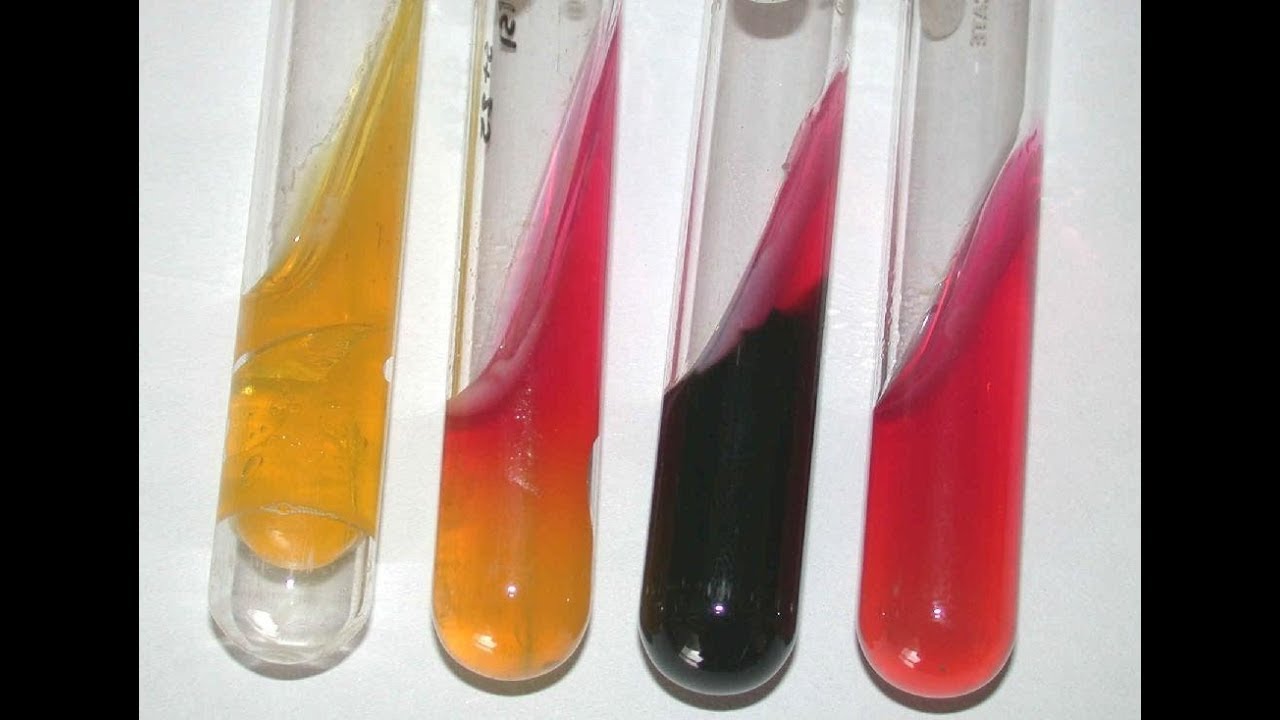 PROVAS BIOQUÍMICAS - CITRATO, UREIA, SIM E TSI (PRINCÍPIOS)