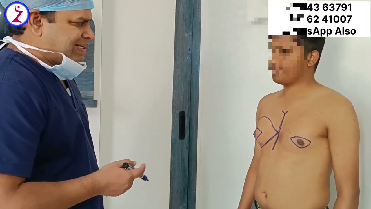 Gynecomastia In Raipur | Gynecomastia Cost In Raipur | Zenith Clinic.