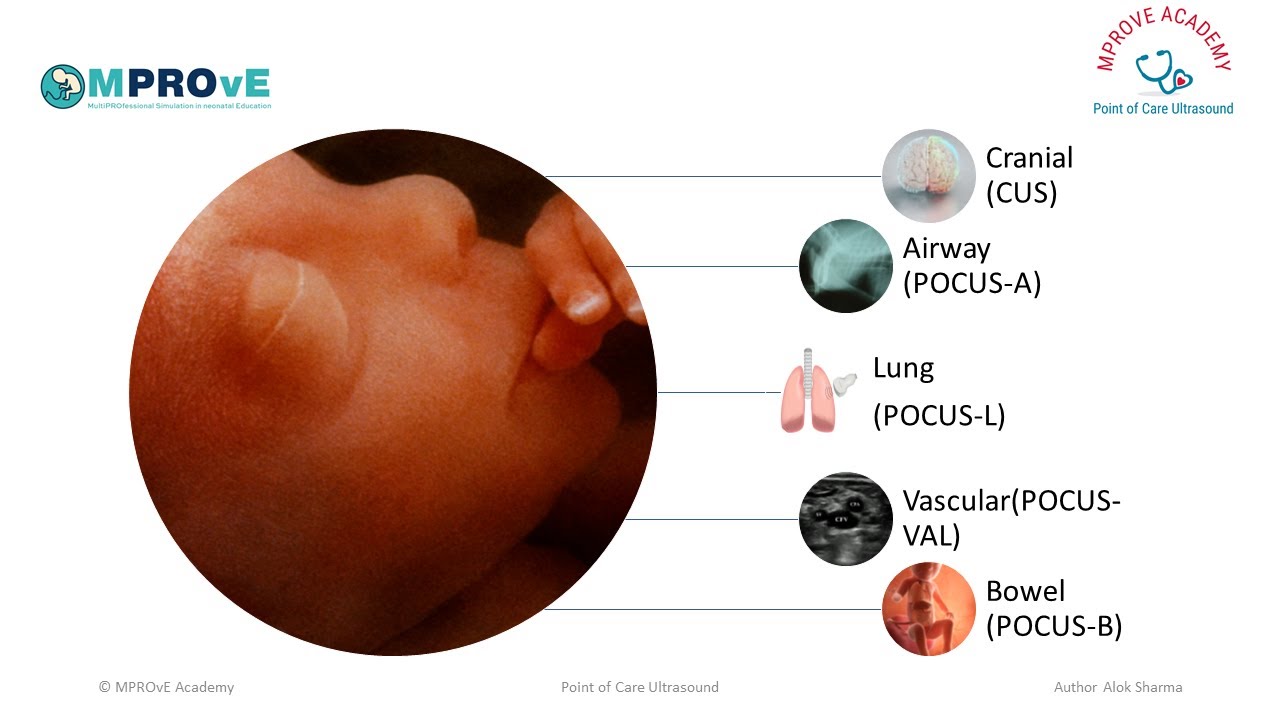 Session 11-Lung Ultrasound in Neonatology RDS in Preterm Babies