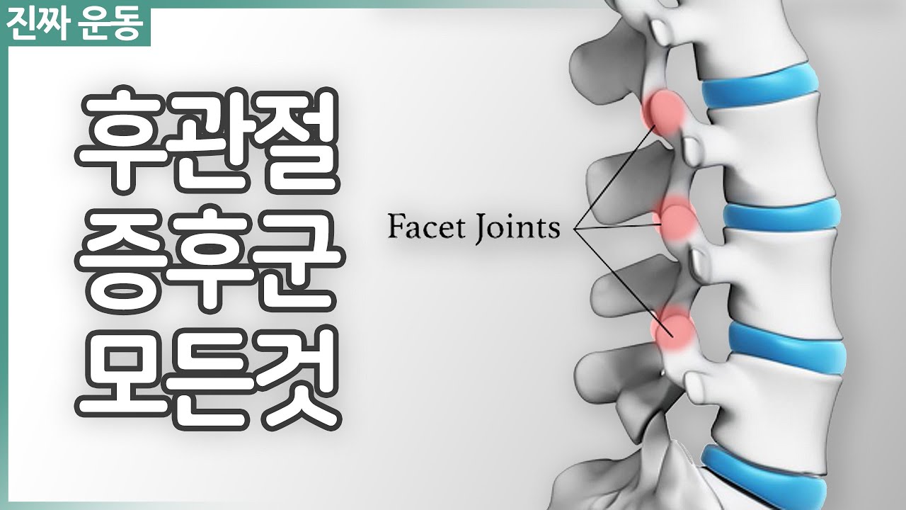 허리가 아픈데 X-ray에 아무것도 안 나와 [후관절증후군]을 의심했습니다 / 증상과 재활법