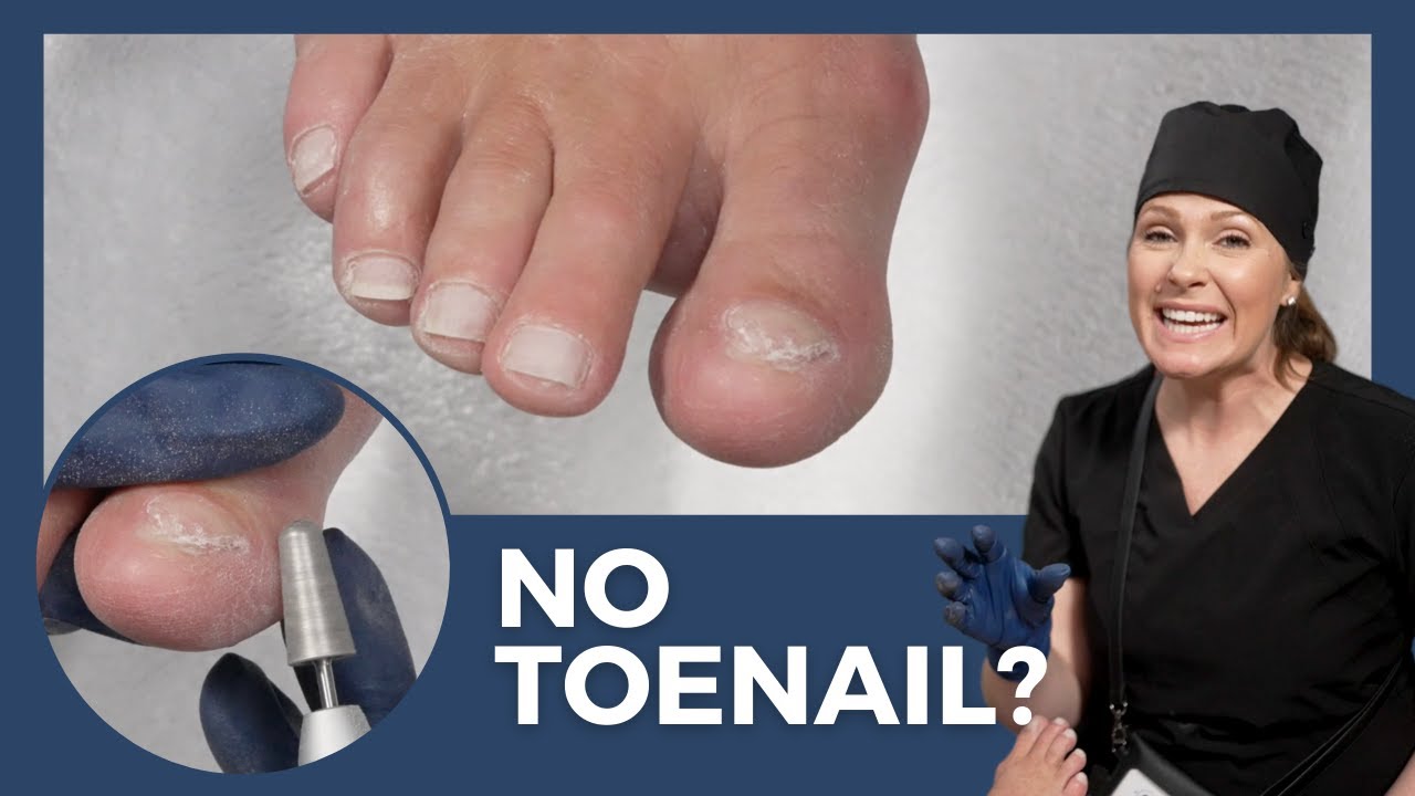 Dry Pedicure with NO TOENAIL - Cuticle Care, Nail Trimming, Callus Exfoliation