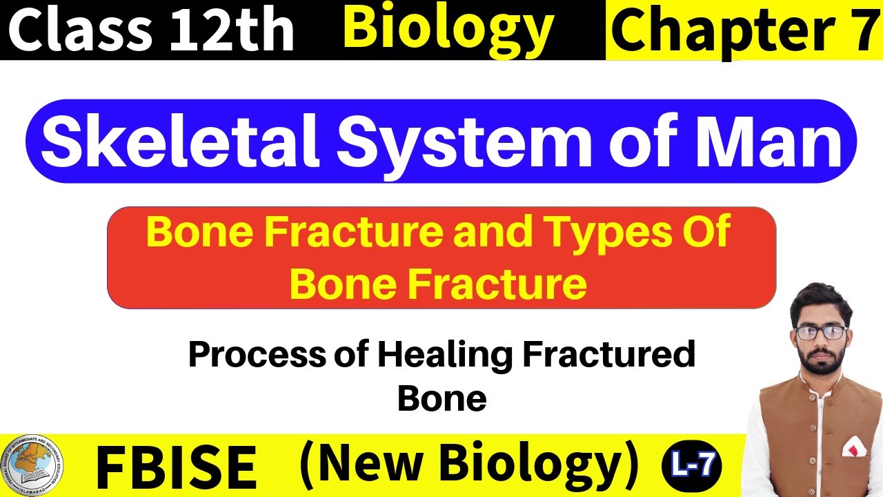 Fracture Healing Process | Bone Fracture & Types of Bone Fracture | FBISE Biology Class 12 |