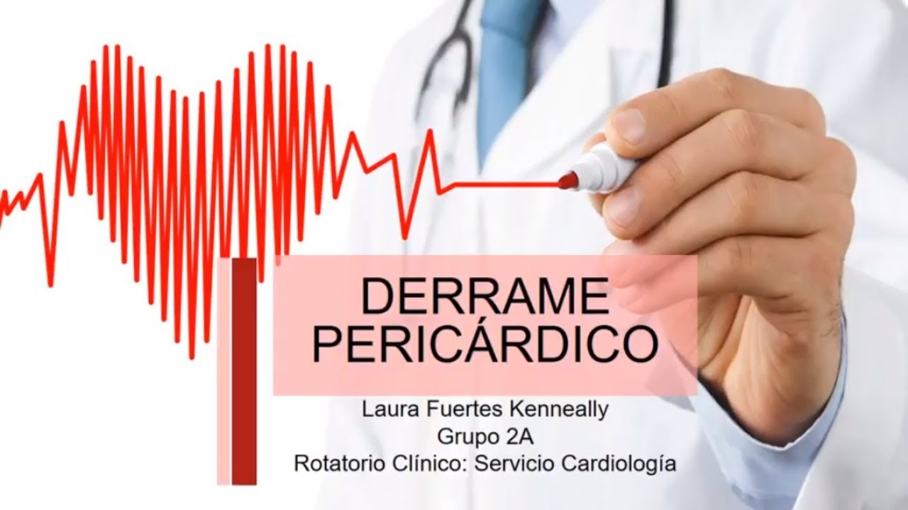 DERRAME PERIC&Aacute;RDICO