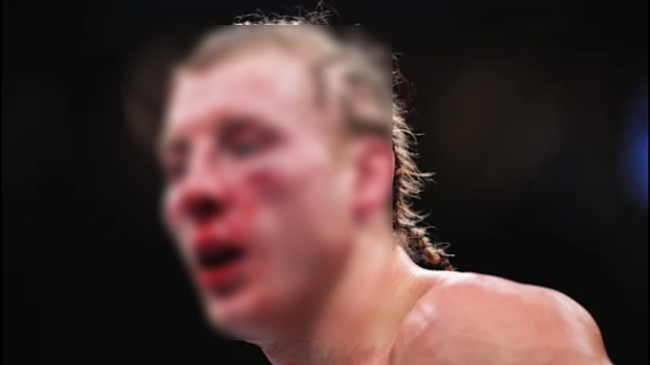 Why Paddy Pimblett Was Taken to Hospital After His UFC Loss — The Medical Reality Explained