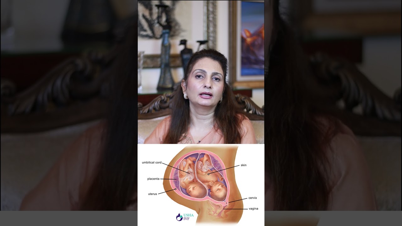Kia IVF Karwanay Se Twins Peda Ho Saktay Han? | Dr. Shamayela Hanif Gynecologist
