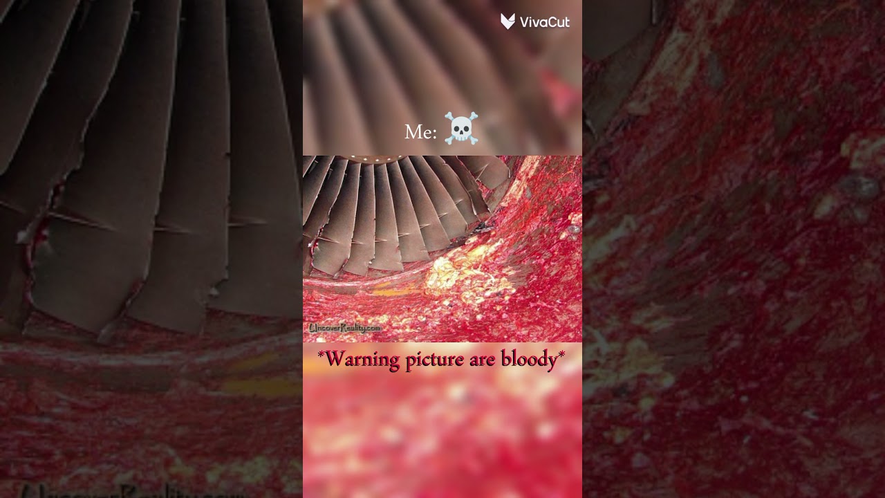 Continental B737-500 ☠️ ⚠️WARNING PICTURES ARE BLOODY ⚠️