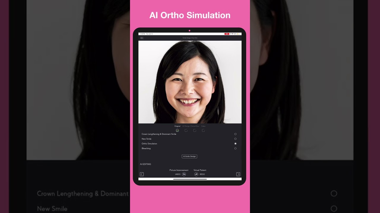 SmileFy 4.8, - ONE-CLICK AI smile simulation