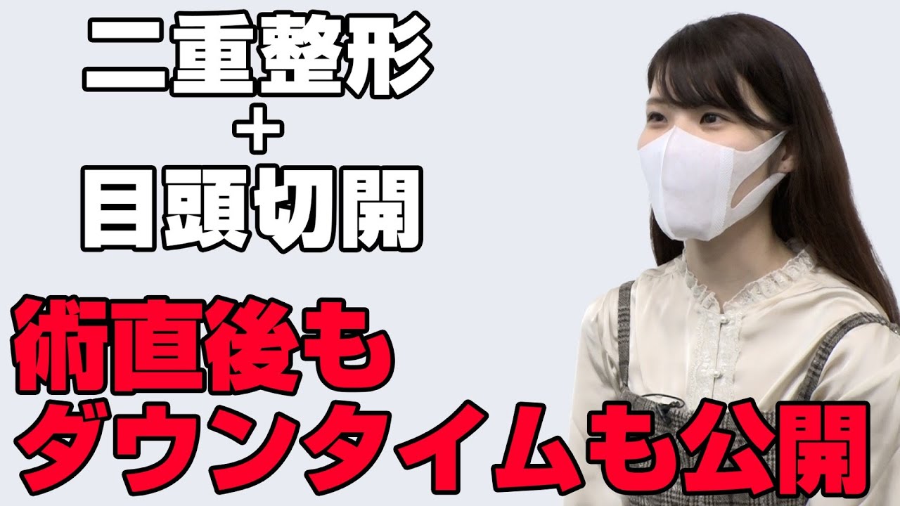 【二重整形】幅広の並行二重になりたいから埋没二重と目頭切開を同時に受けてみた【湘南美容クリニック】