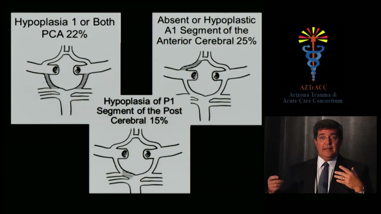 Screening, Diagnosis, and Management of Blunt Cerebrovascular Injury