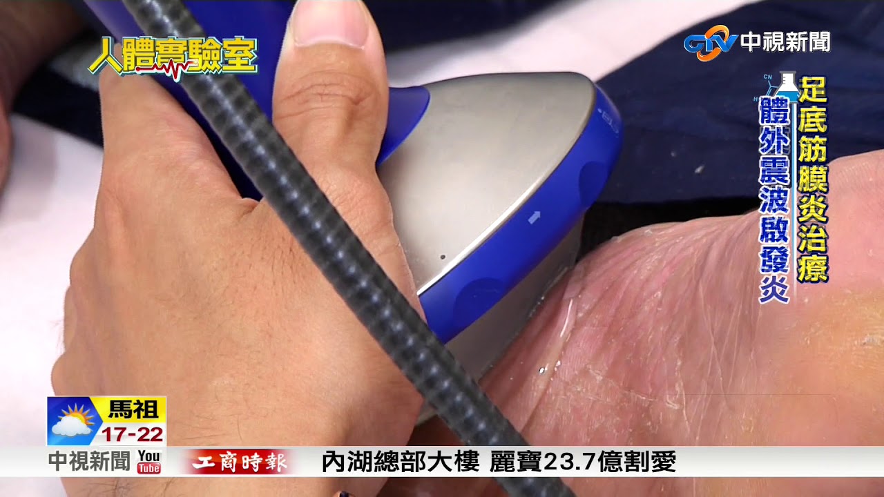 人體實驗室~足底筋膜炎治療 震波或增生注射│中視新聞 20180418