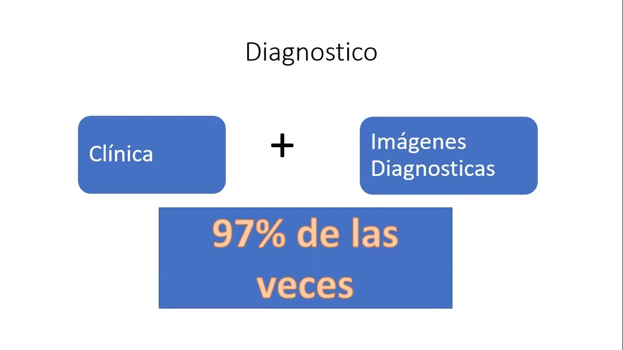 Síndrome de dolor trocantérico