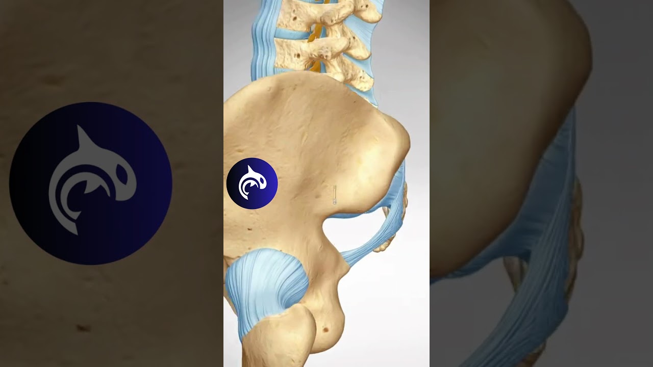 See how a Sacroiliac Joint Fusion restores function and relieves pain in 3D animation.