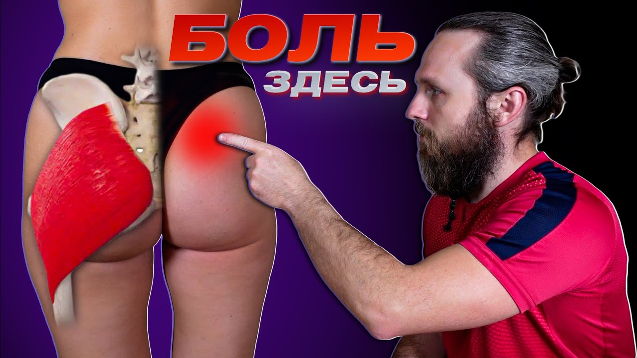 БОЛИТ ЯГОДИЦА, КРЕСТЕЦ и КОПЧИК? Избавься от боли за 5 минут!