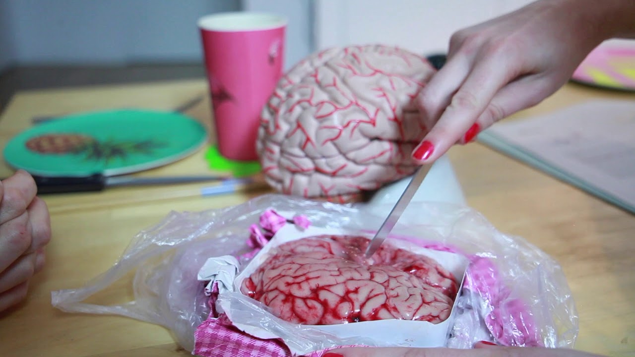 La matière grise et la matière blanche (MTTVC 4)