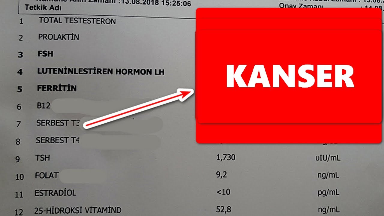 KANSER HASTASININ TİPİK KAN TAHLİL SONUCU! / KANSER TAHLİLİ NASIL YAPILIR?