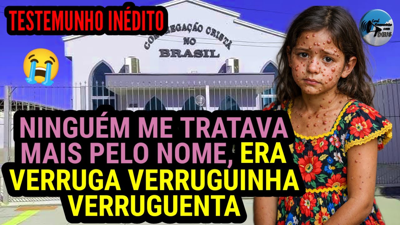 Testemunho CCB- Verruga, Verruguinha, Verruguenta - Assim ela era chamada | Você vai se emocionar