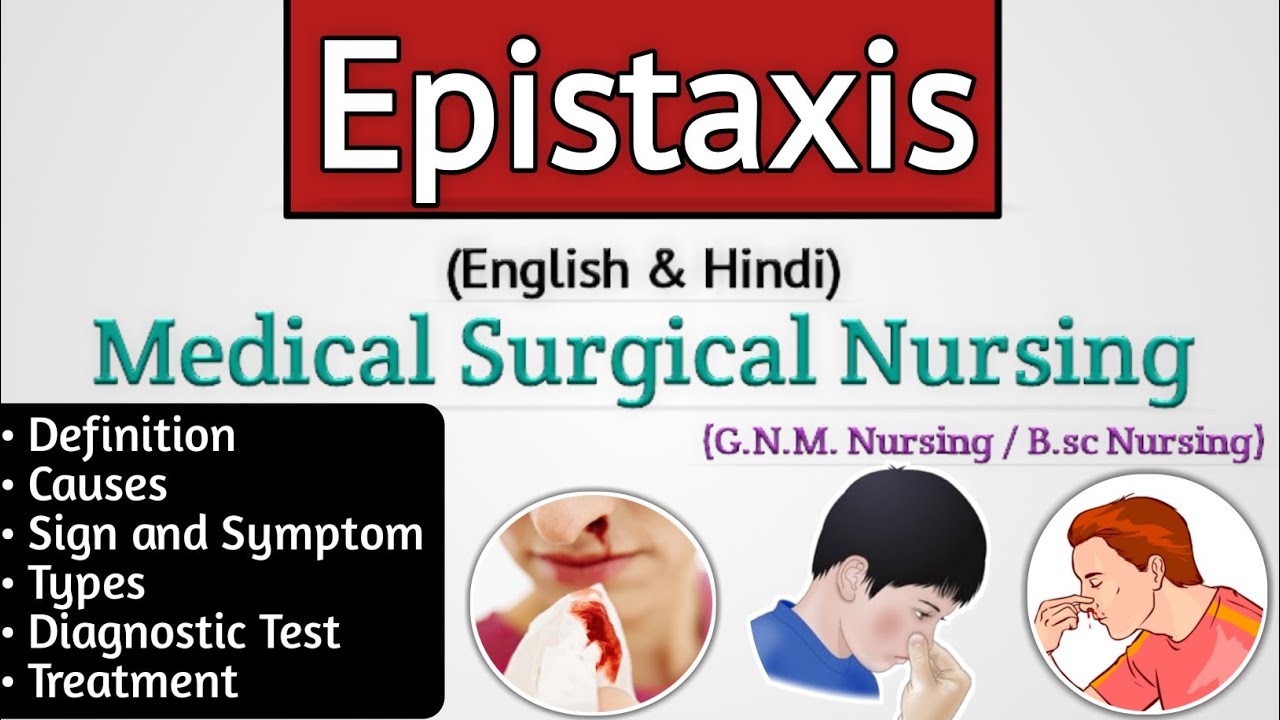 Epistaxis ent lecture // Epistaxis in hindi - (Nosebleed)