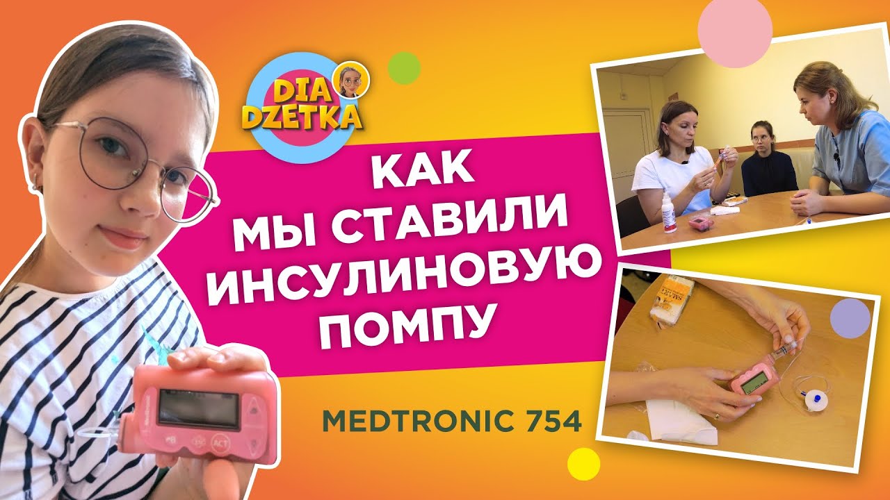 Установка инсулиновой помпы пошагово 🩺⚙️🩸