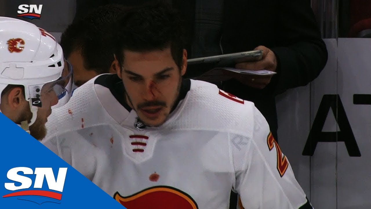 Blackhawks' Chris Kunitz Ejected For Elbow On Flames' Travis Hamonic