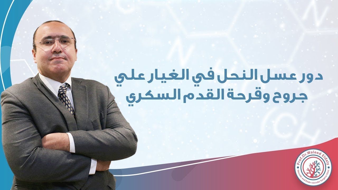 دور عسل النحل في الغيار علي جروح وقرحة القدم السكري | دكتور وليد الدالي