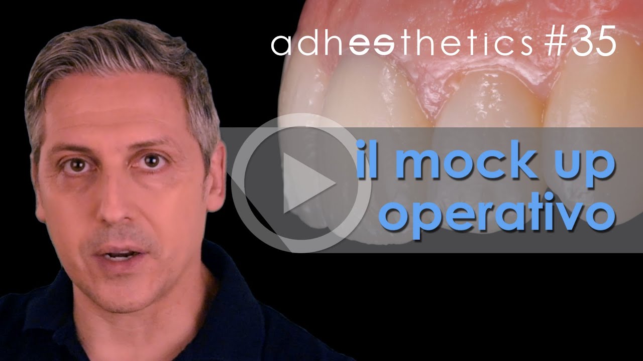 🇮🇹 Il mock up operativo_corto#35 ITA_Adhesthetics Protocols