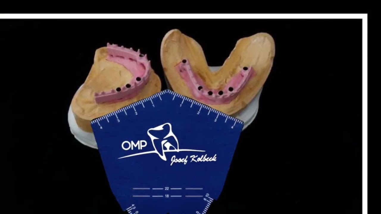 Occlusal Measurement Plane OMP By Jkolbeck CDT / Education