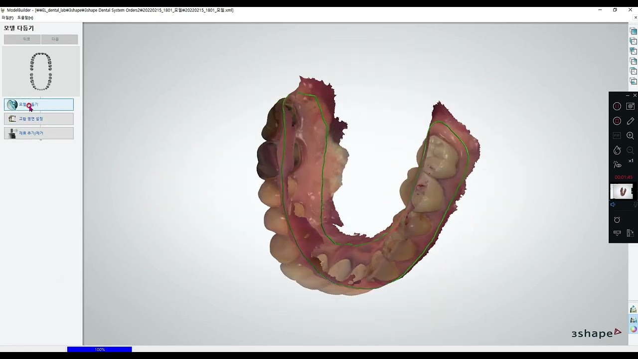 3shape modelbuilder
