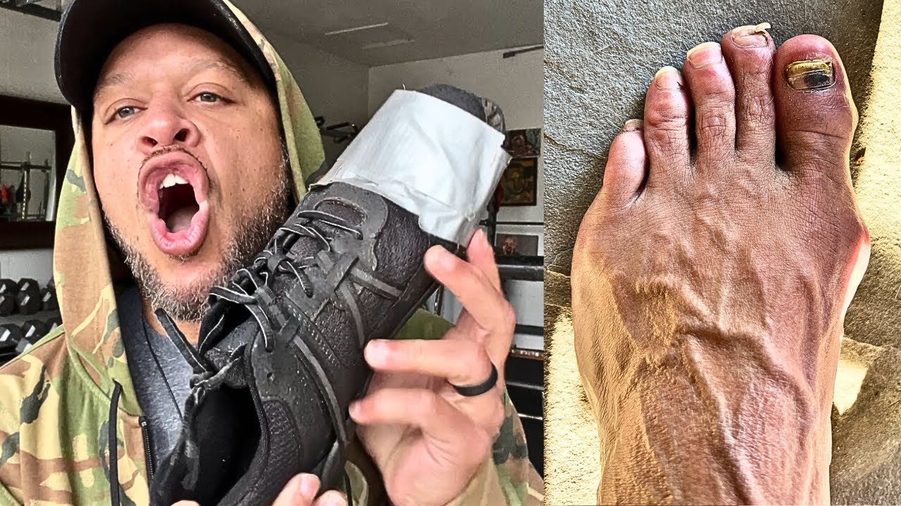 BAD SHOES ruined my athletic career.