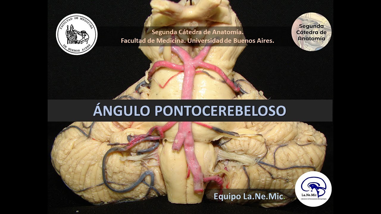 N2 | Ángulo pontocerebeloso | Anatomía 2 | FMed UBA