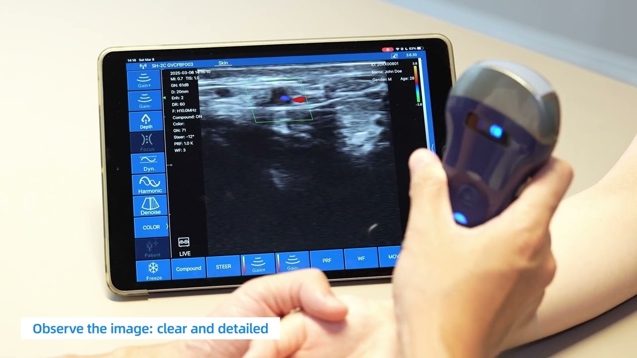 Viatom Pocket Ultrasound Operation Demo