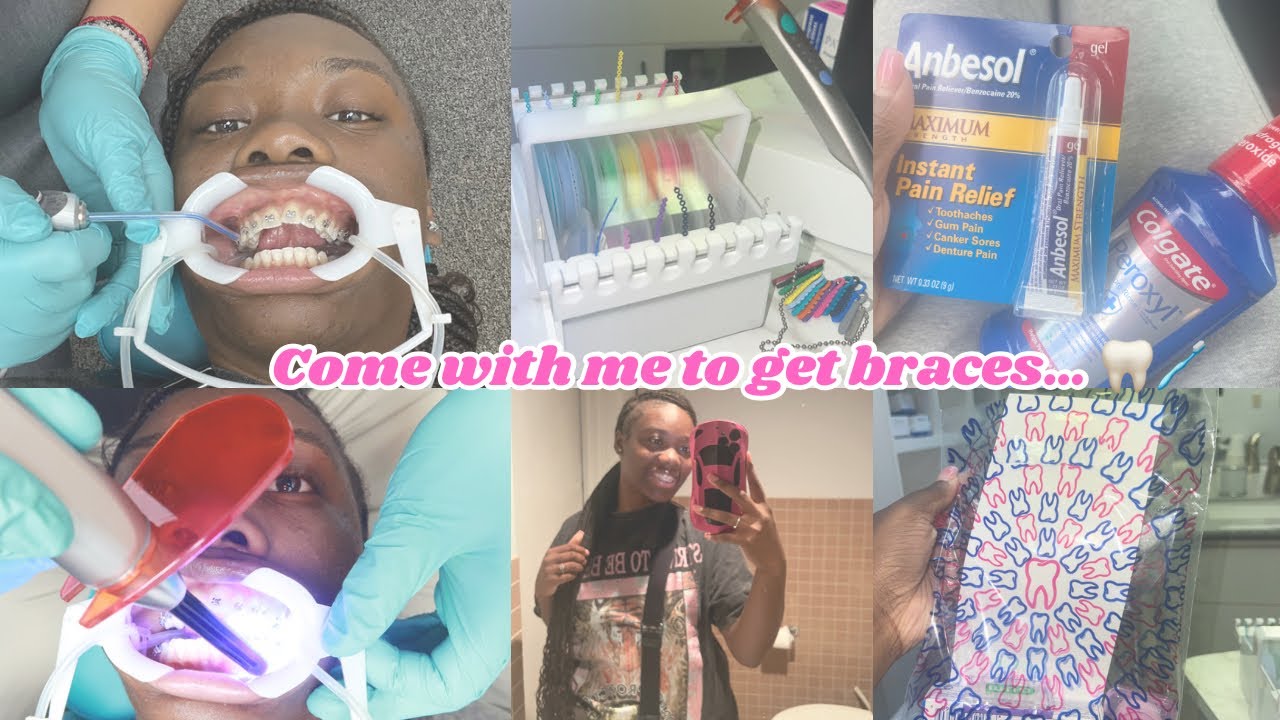 Come with me to get braces 😬🦷 | Detailed Video