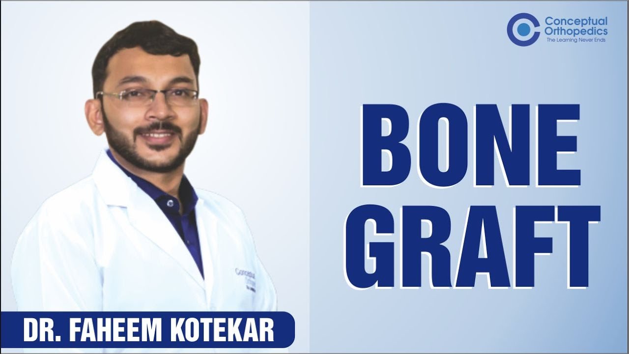 Bone Graft by Dr Faheem Kotekar | Conceptual Orthopedics