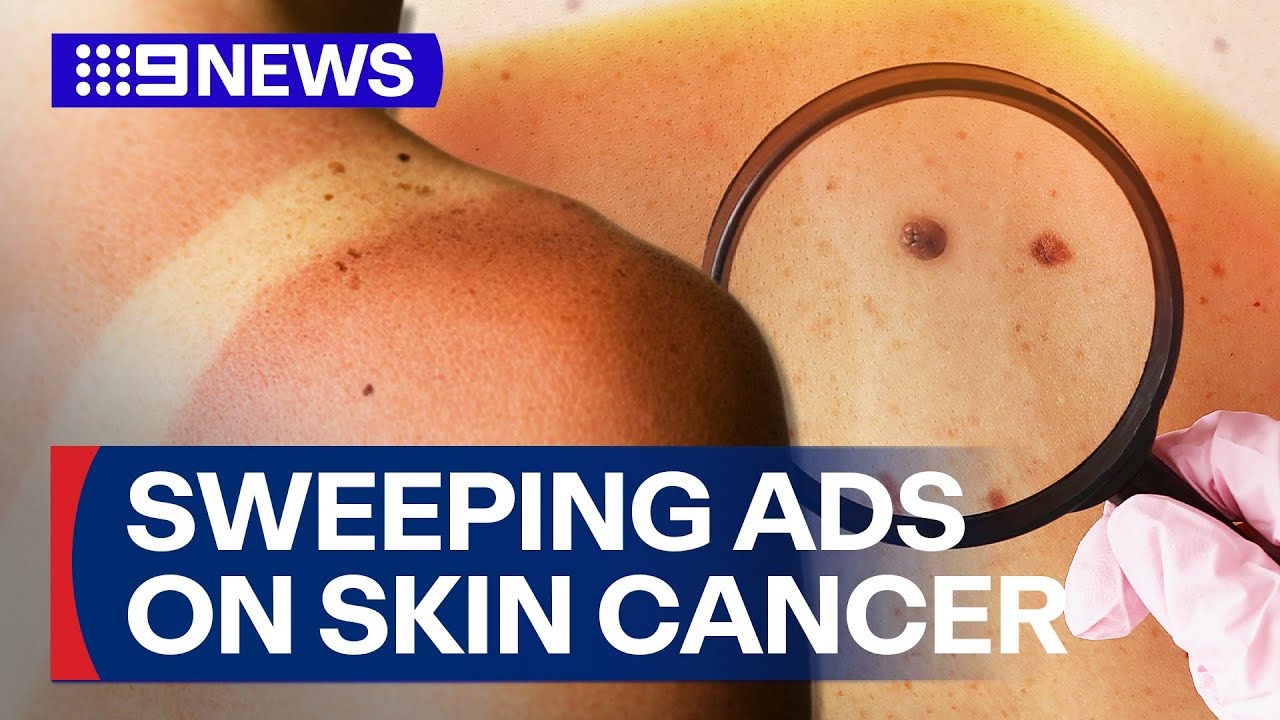 Sweeping ads to warn of skin cancer for younger generation in particular | 9 News Australia