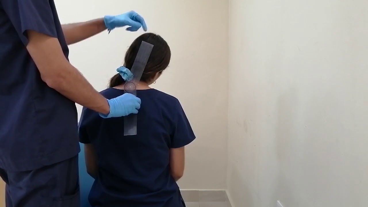 Goniometría cervical