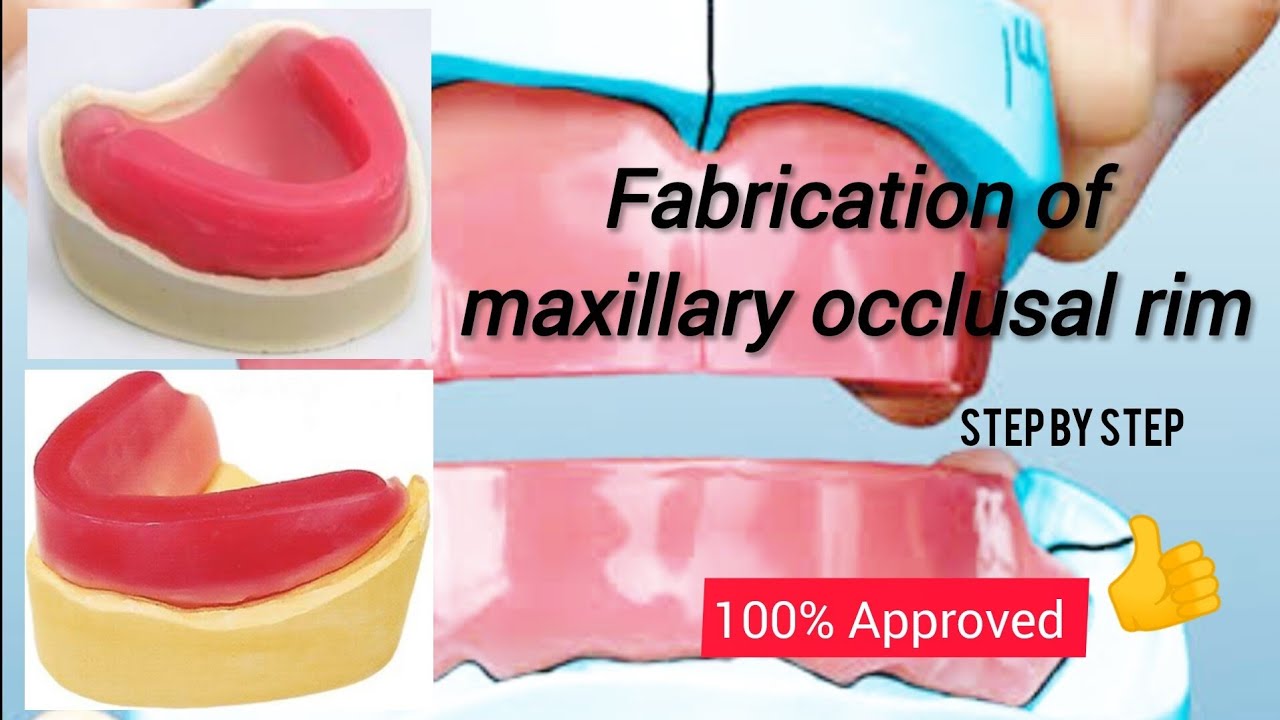 Fabrication of maxillary occlusal rim || preclinical prosthodontics || step by step