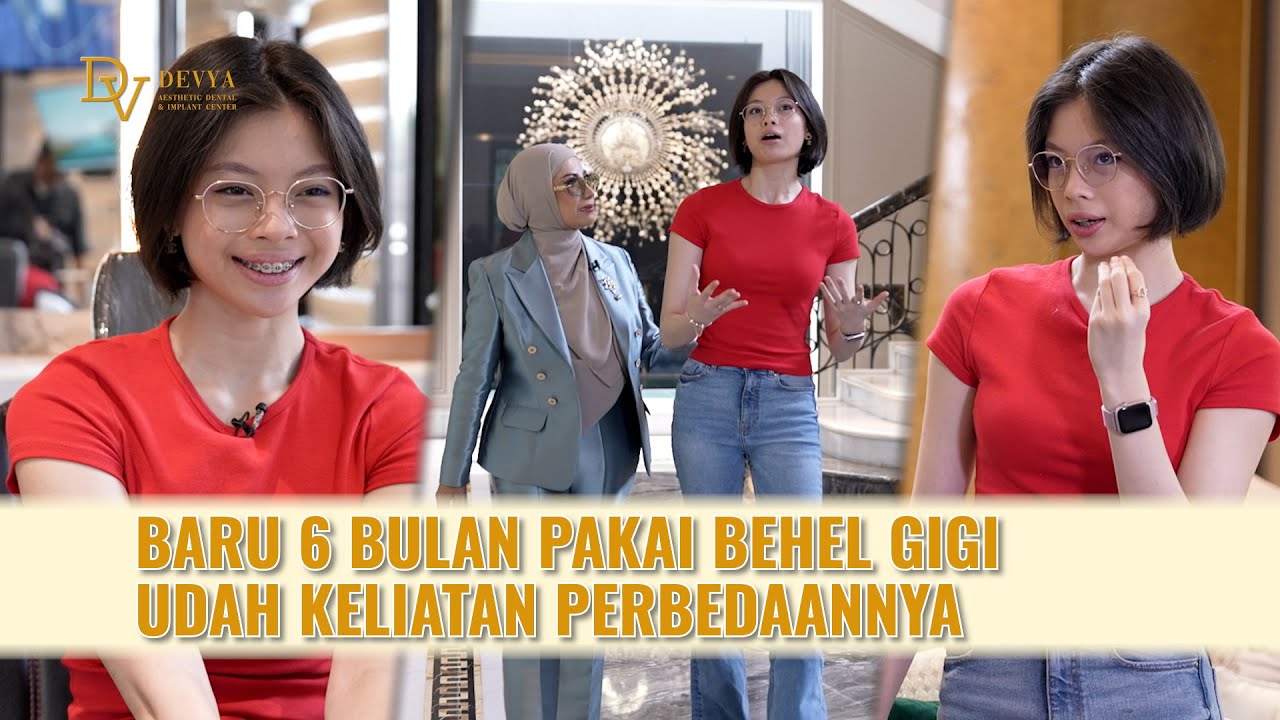 6 BULAN PAKAI BEHEL, GIGI NADA CORBUZIER JADI JAUH LEBIH RAPIH