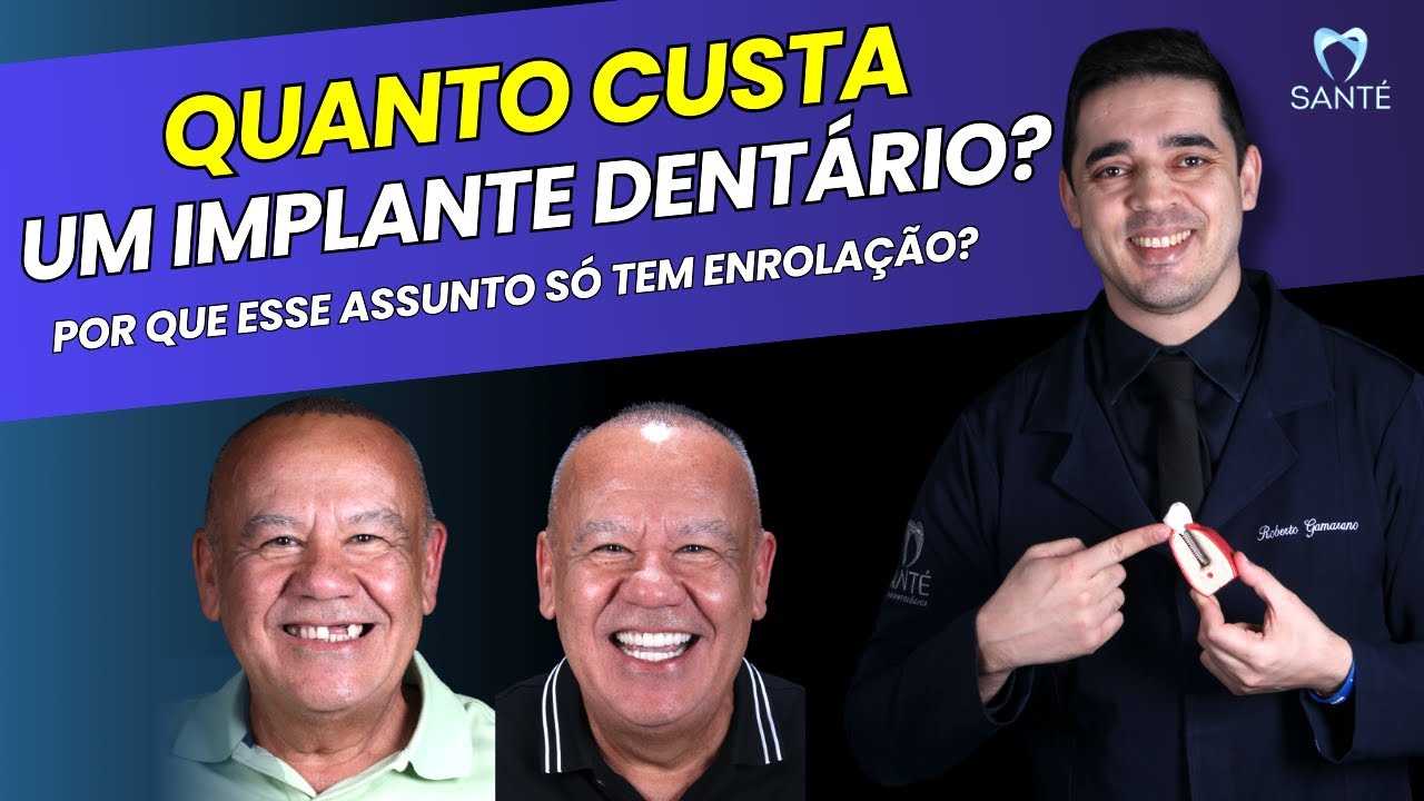 Preço do Implante Dentário - Dicas e Orientações Para Entender Quanto Custa o Implante