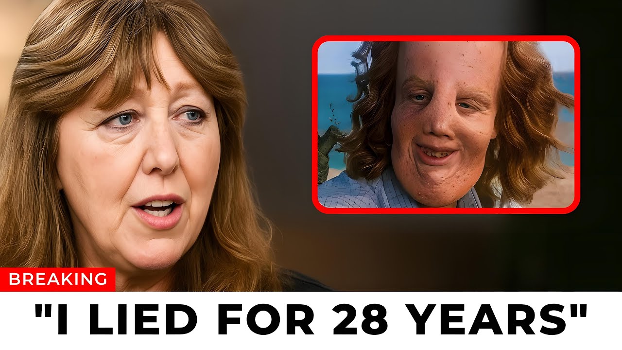 Before She Died, Rocky Dennis's Mom FINALLY Broke Silence About Rocky Dennis And It's Not Good