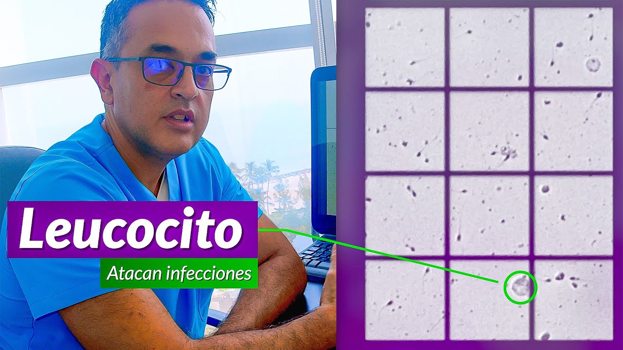 Curamos la azoospermia [Semen sin espermas] infertilidad masculina: Seminograma o espermatobioscopía