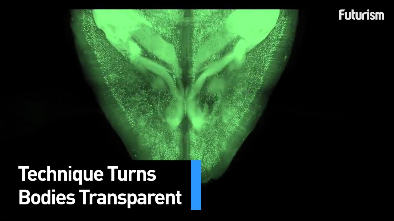 Transparent Brains and Bones