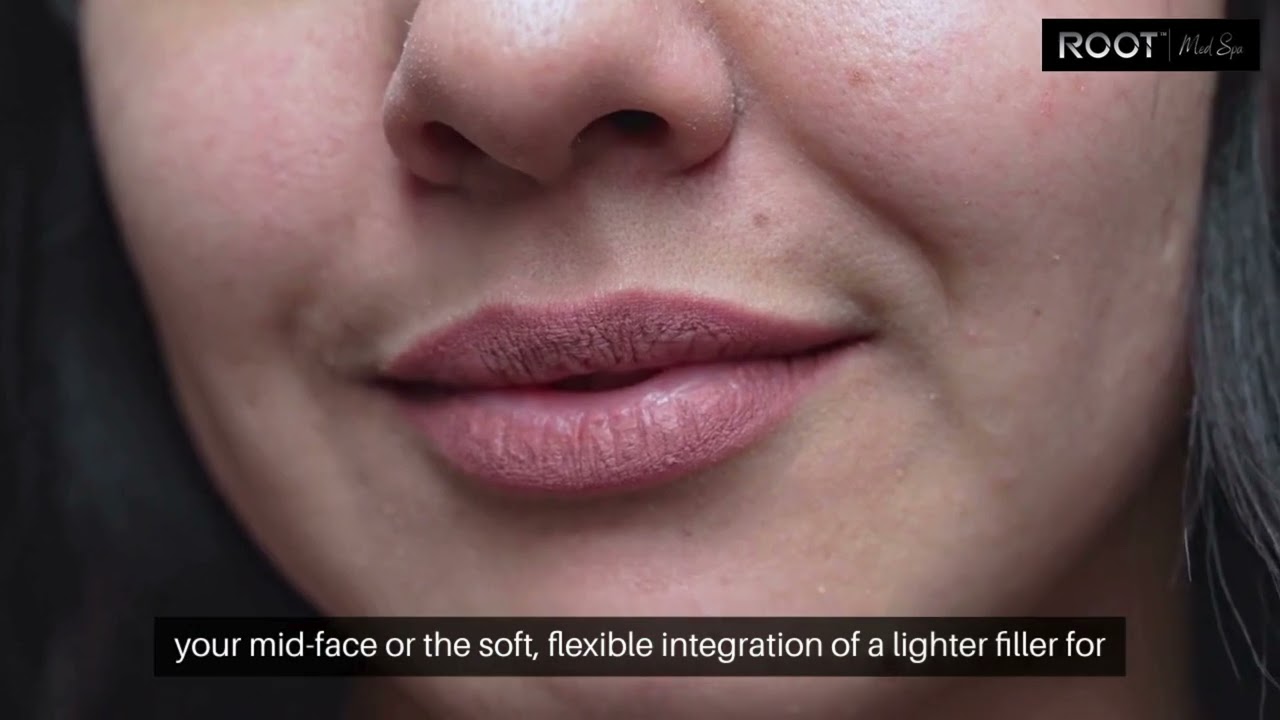 SkinPen Microneedling in Flower Mound, TX: See the Before & After