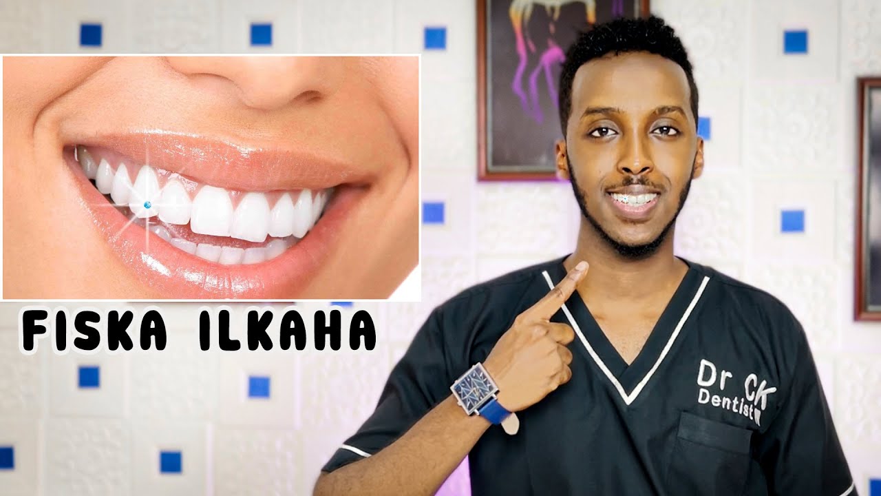 Fiska Ama Dahabka Ilkaha Lagu Qurxiyo | TOOTH JEWERLY