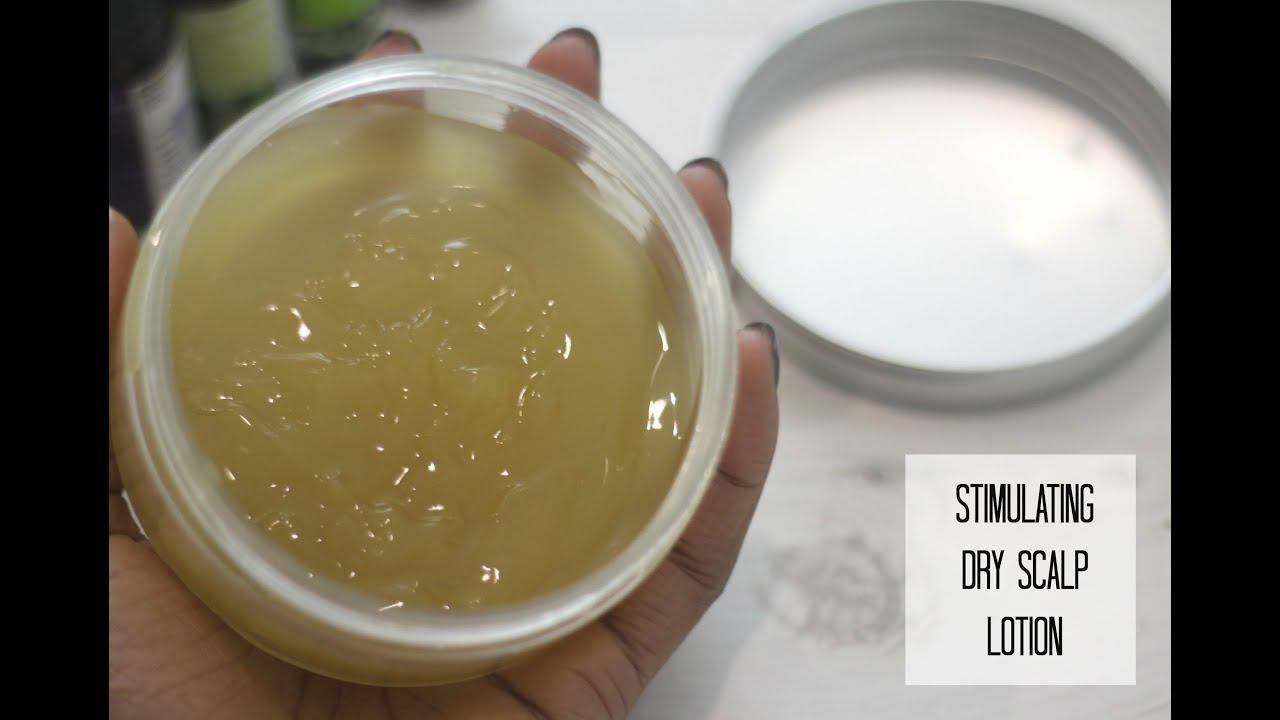 [DIY] Easy & Affordable Dry Scalp Lotion : My Dry Scalp Transformation