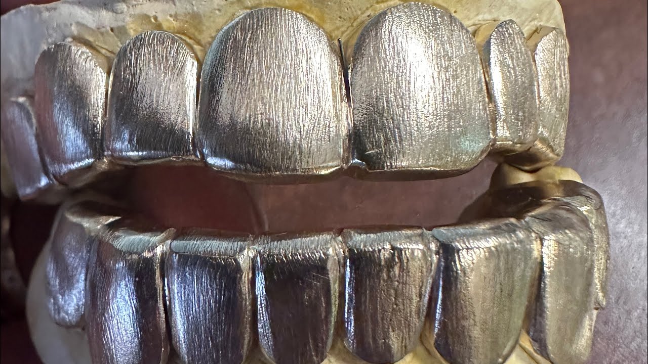 Seattle Gold Grills is live!  Grillz cover missing teeth!!