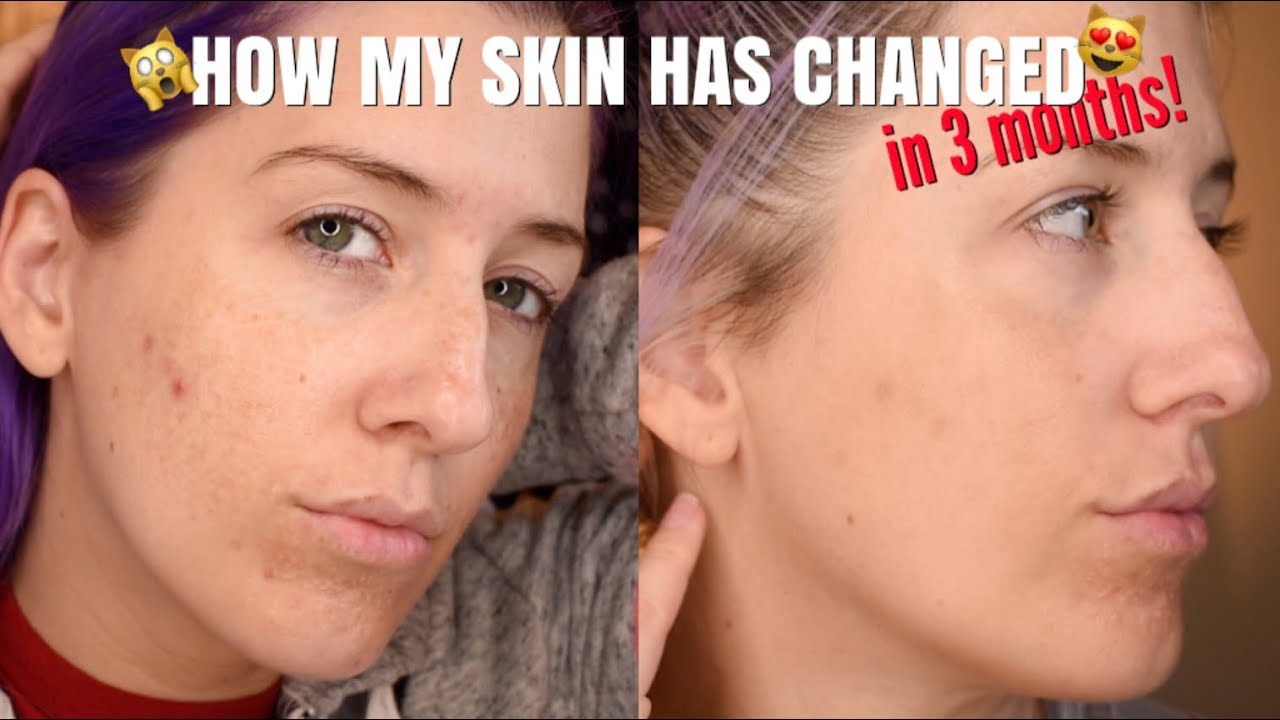 My Skincare Routine + JAN MARINI Skin Care Management System REVIEW!