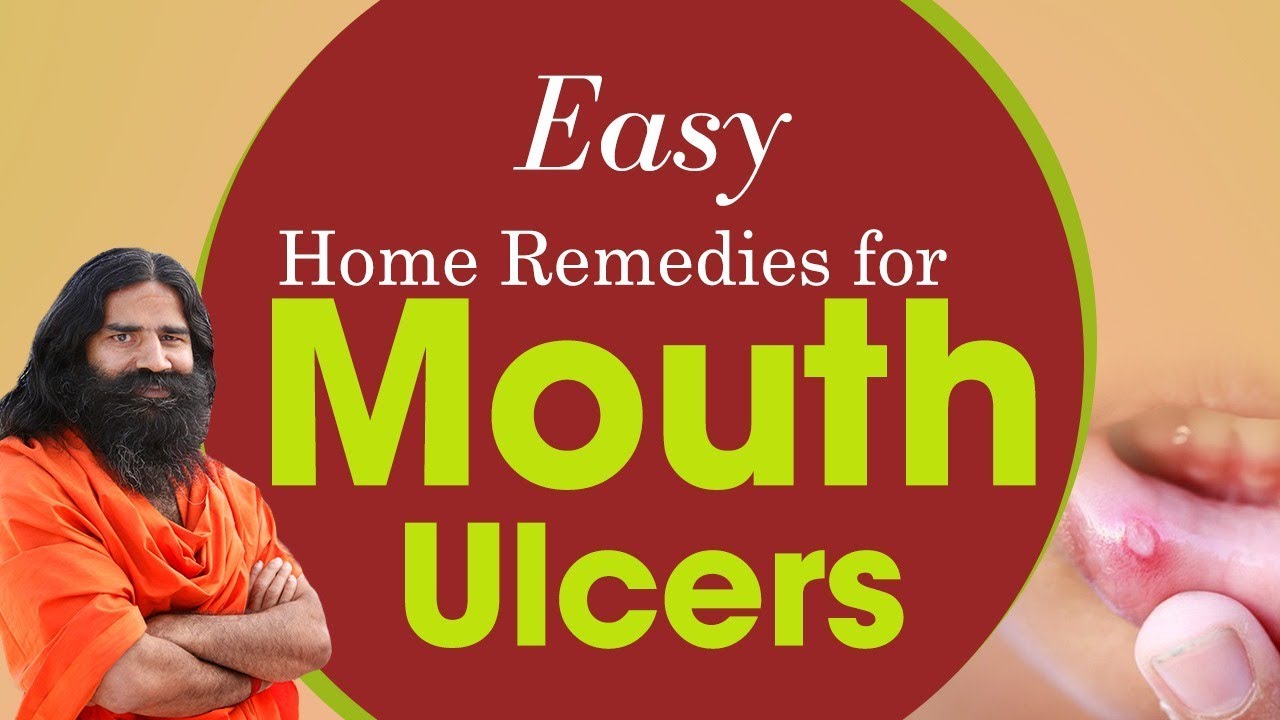 Easy Home Remedies For Mouth Ulcers | Swami Ramdev