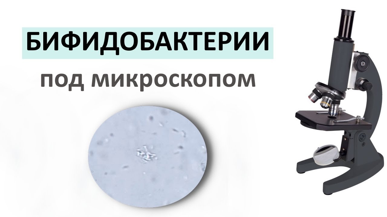Препарат с бифидобактериями под микроскопом. Важность бифидобактерий.