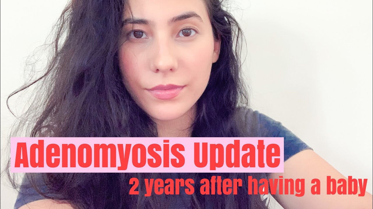 Adenomyosis Update! (2 Years After Having a Baby)